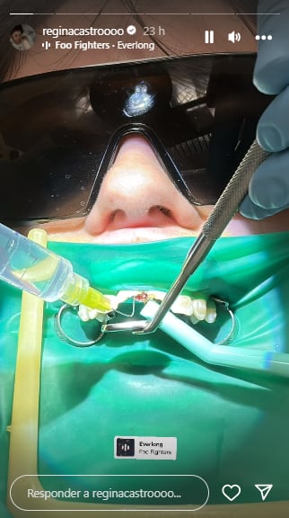 Regina Castro perdió los dientes en un accidente mientras montaba a caballo