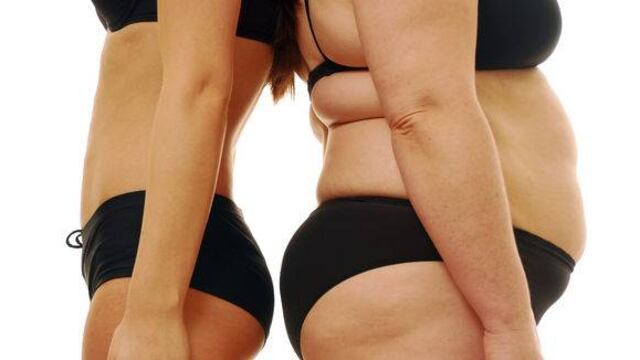 La obesidad androide se presenta más en hombres que en mujeres.