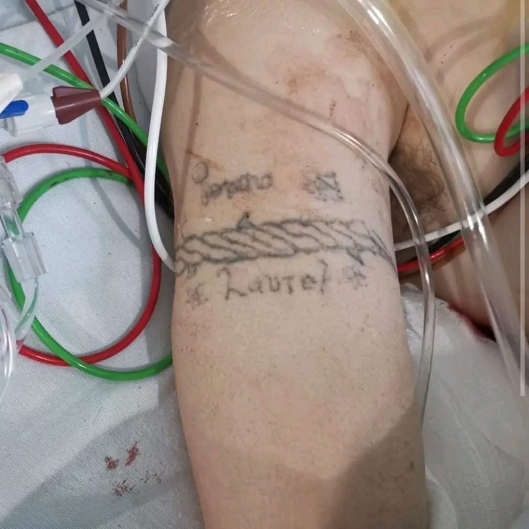 Piden identificar a víctima de explosión de pipa en Iztapalapa mediante tatuaje