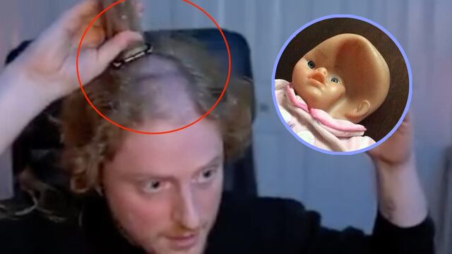 Un streamer se rapa en vivo y descubre que su cabeza está abollada por los audífonos
