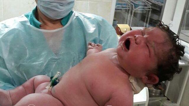 Bebé de 6.3 kilos nace en Rusia