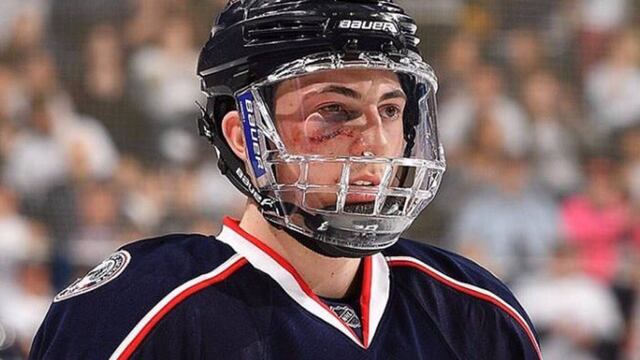 Zach Werenski regresó a jugar pese al golpe.