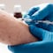 Viruela del mono en Suecia: Reportan el primer caso de mpox cepa mortal fuera de África