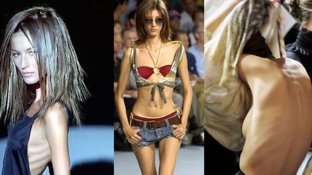 Modelos usan malla en la lengua para bajar de peso y mantenerse extremadamente delgadas.