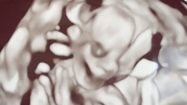 La foto del bebé causó horror a los usuarios de TikTok