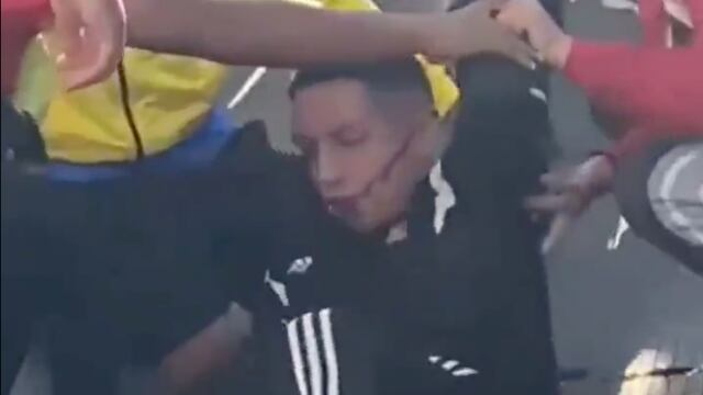 Seguidor del Club Tigres recibió paliza de fans del Club León