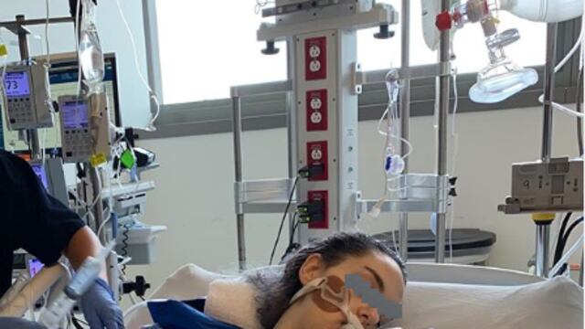Simah Herman, de 15 años, tuvo que ser puesta en coma y conectada a un respirador artificial por usar cigarros electrónicos.