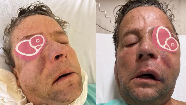 Alfredo Adame a 24 horas de haber sido operado.