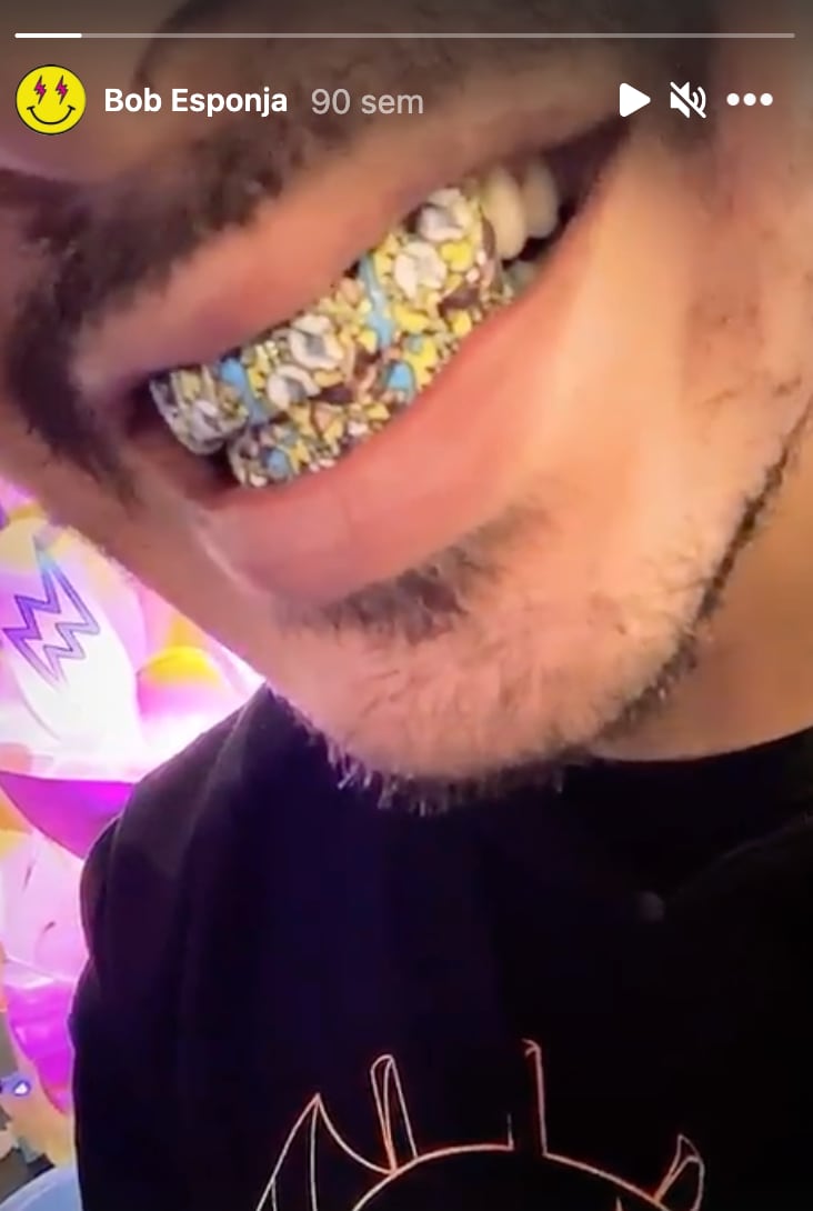 Incrustaciones en dientes de J Balvin