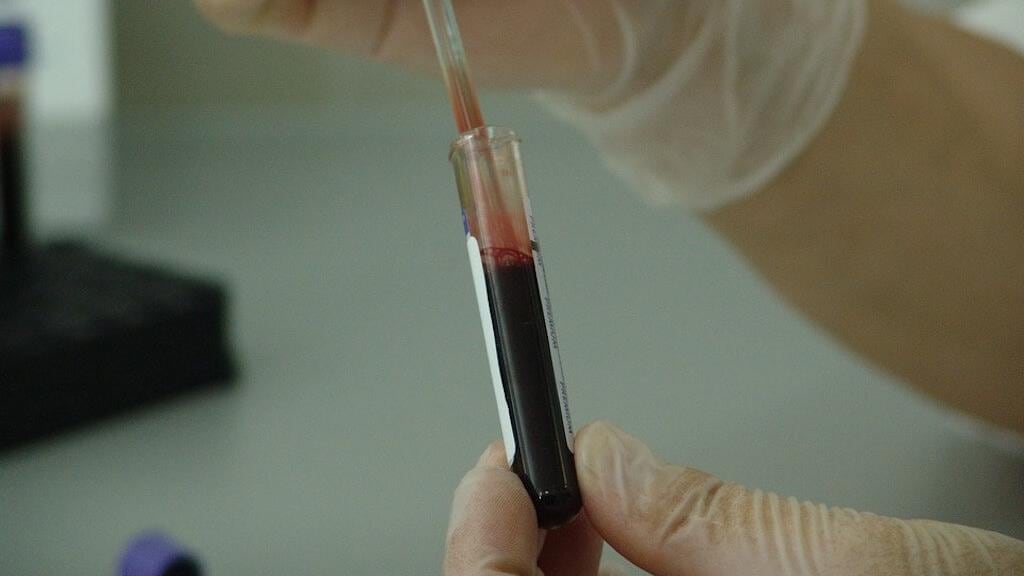 Pruebas de sangre.