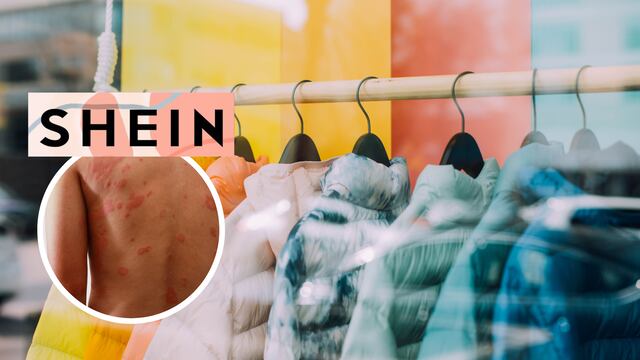 Shein, ropa, dermatitis