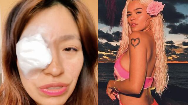 Fan de Karol G casi se queda ciega