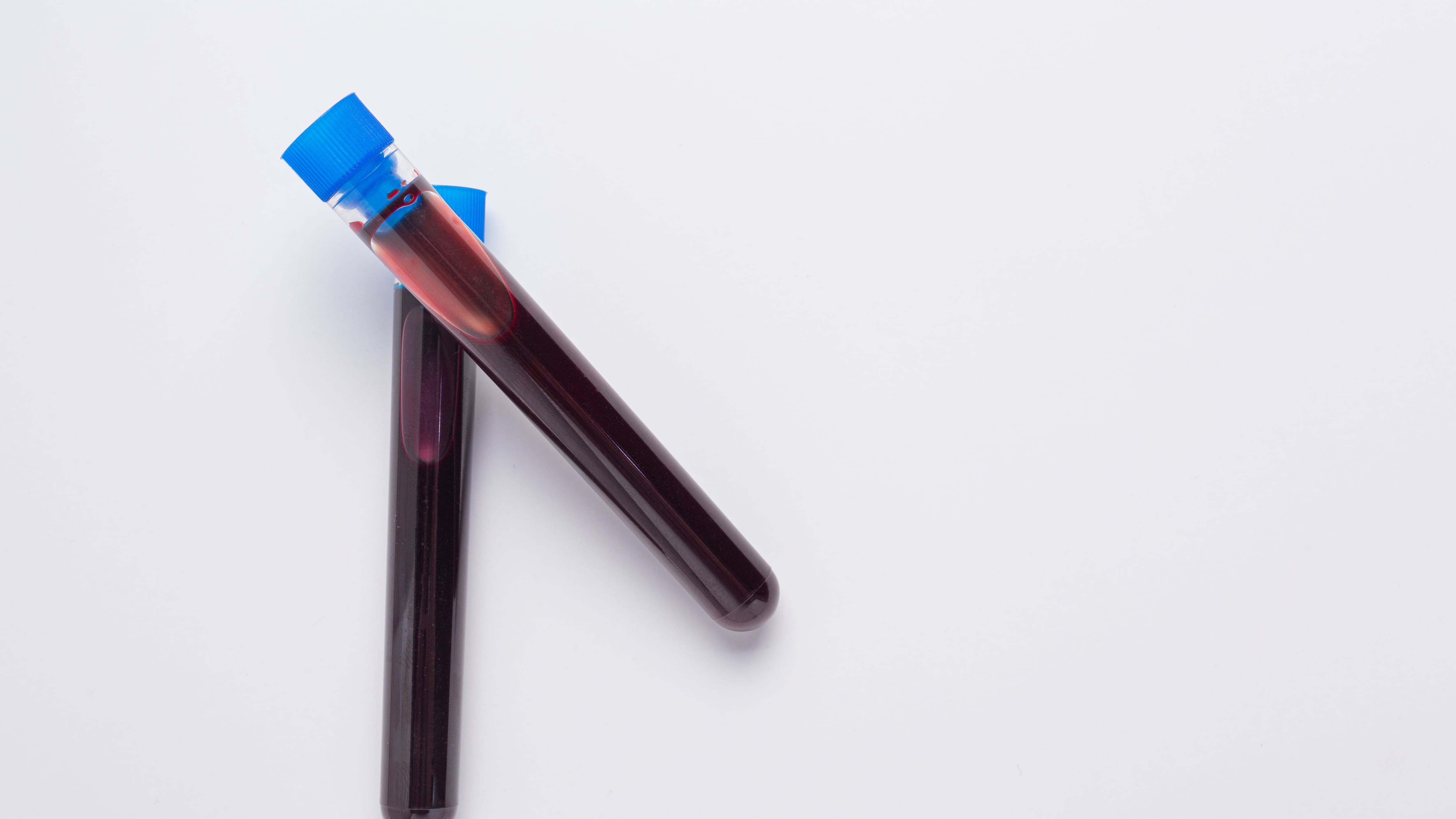 Si tienes este tipo de sangre vivirás más tiempo, según estudio de longevidad