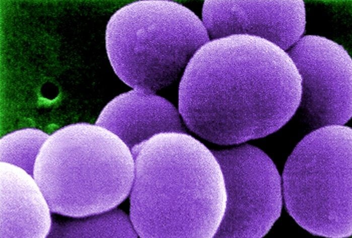 Bacteria Estafilococo áureo