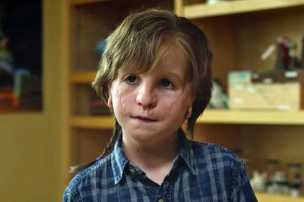 Extraordinario, película que habla del síndrome de Treacher Collins