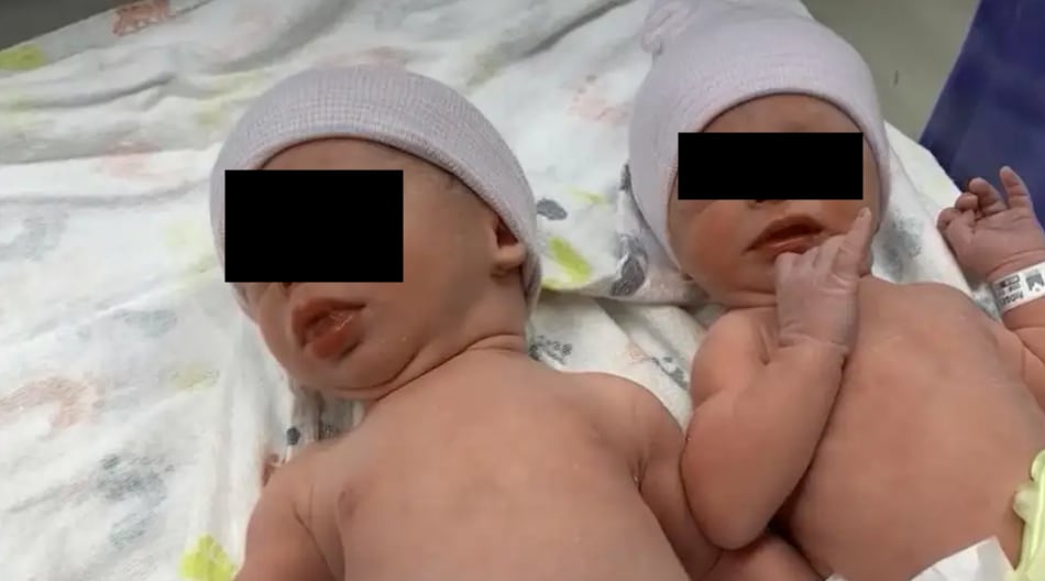 Mellizos de embriones congelados