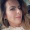 Kate del Castillo muestra las consecuencias de su accidente