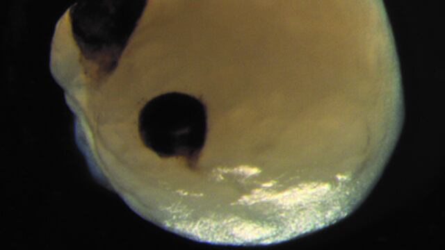 Organoides cerebrales