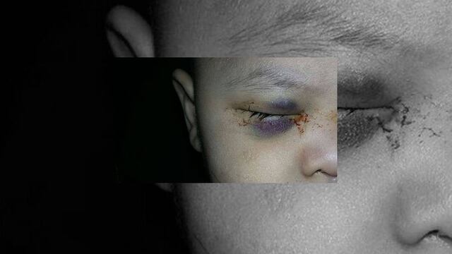 Cirugía en ojo sano del menor no fue error: IMSS