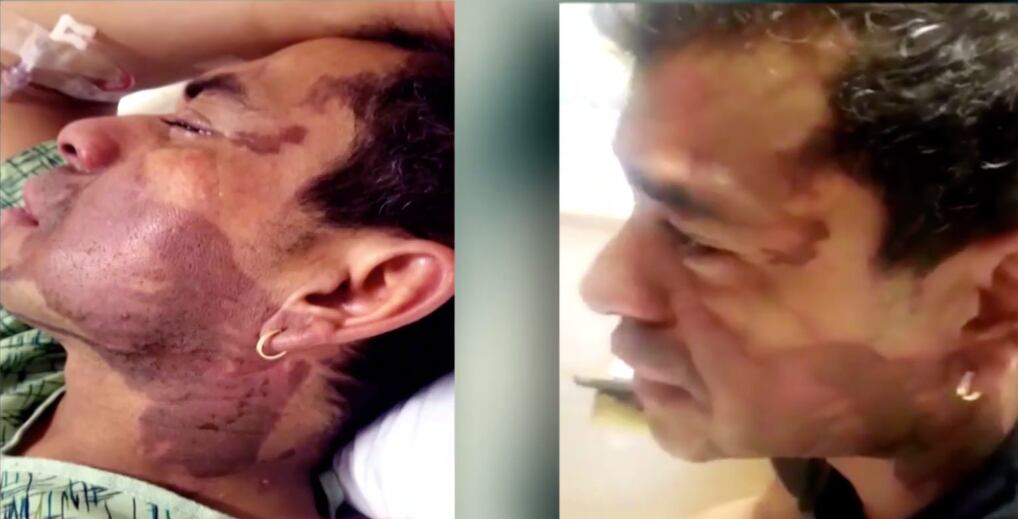 Víctima de ataque de odio en EU.