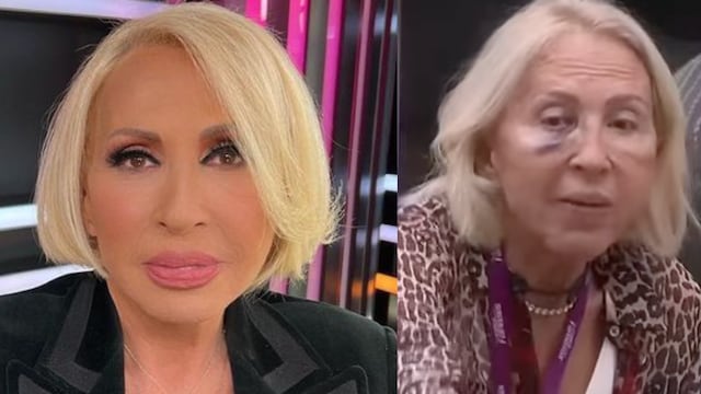 Se le cae un diente a Laura Bozzo