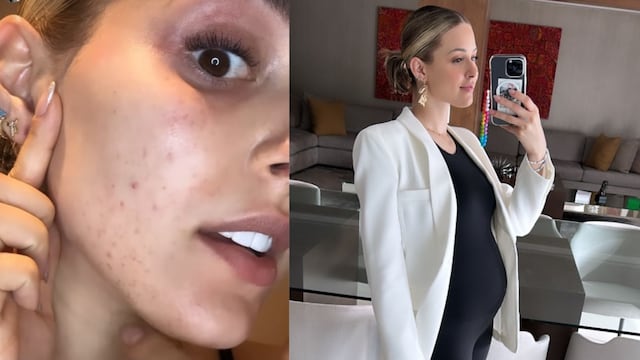 Mariana Rodríguez: Se muestra sin maquillaje y con granos rojos en la cara.