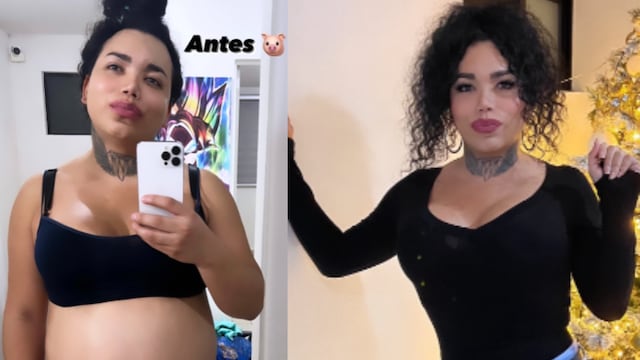 Paolita Suárez comparte su antes y después de la operación que se hizo.