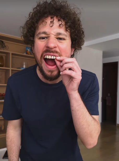 Los dientes caídos de Luisito Comunica fueron pura publicidad del influencer