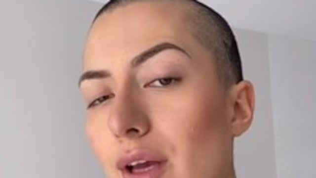 Influencer que uso Kola Loka en los ojos ya está mejor (VIDEO)