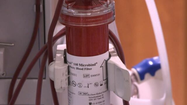 Filtro de sangre desarrollado por DARPA para tratamiento contra covid-19