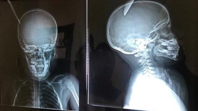 Lanza cuchillo a niño de 5 años 'jugando'