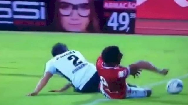 Bruno Mezenga sufrió una brutal fractura en el brazo