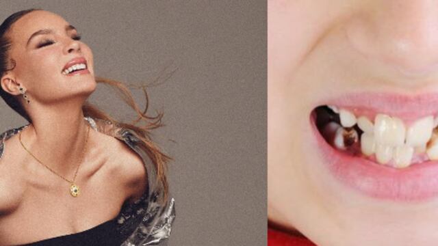 Belinda y sus dientes desatan memes