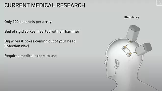 Elon Musk y Neuralink preparan ensayos para implantar microchips cerebrales en humanos