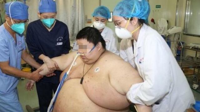 Paciente con sobrepeso