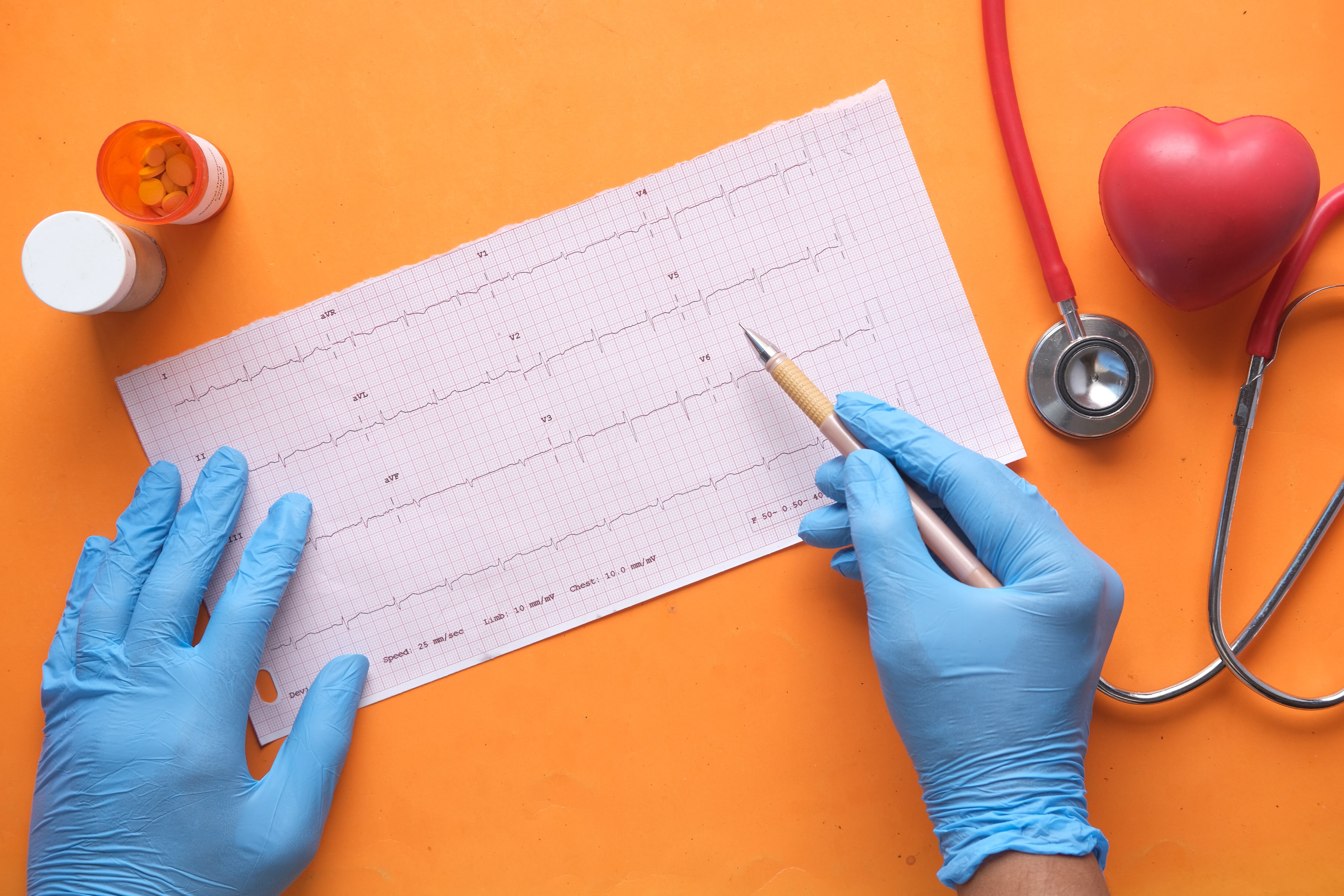 Google premia proyecto de la UNAM que detecta arritmia