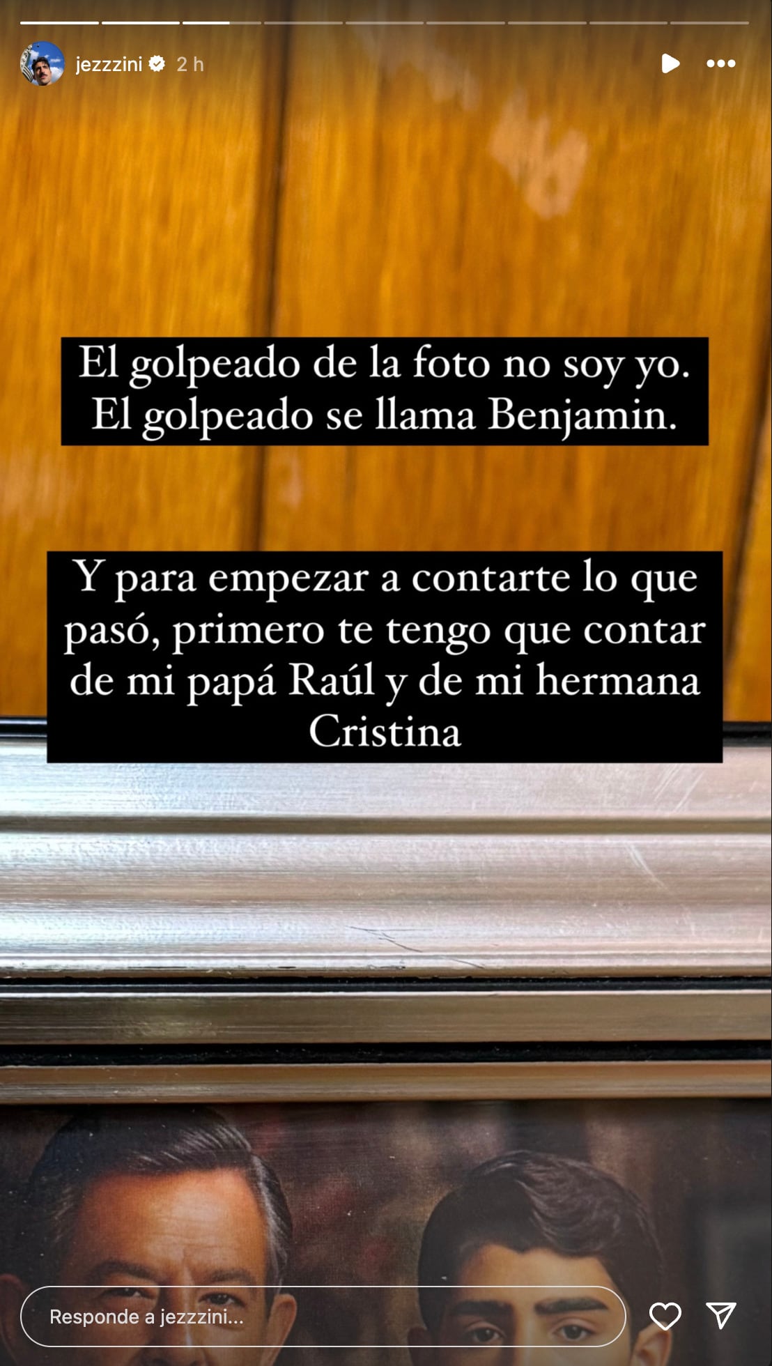 La cara ensangrentada de Jezzini revela que será parte de la nueva serie de Netflix