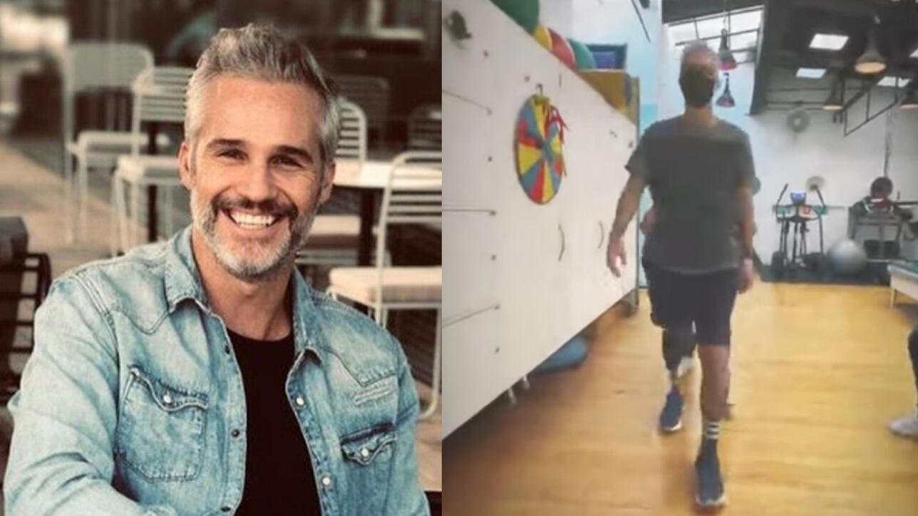Juan Pablo Medina muestra cómo es la rehabilitación con su prótesis de pierna (VIDEO)