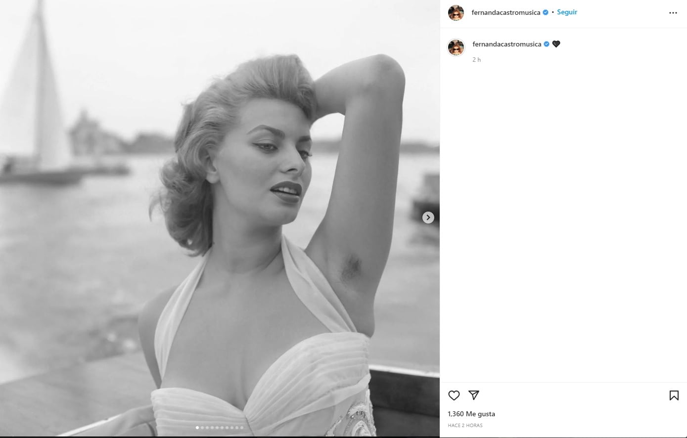 Fernanda Castro muestra famosas con vello en sus axilas