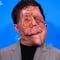 ¿Qué enfermedad tiene Adam Pearson, actor de la película Un hombre diferente? Te contamos