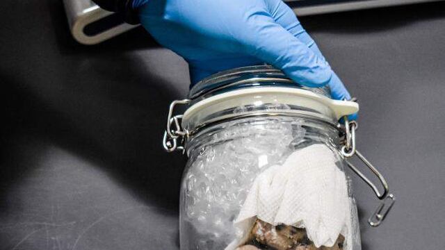 Decomisan cerebro humano en frontera de los Estados Unidos.