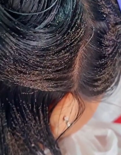 Cabeza llena de liendres