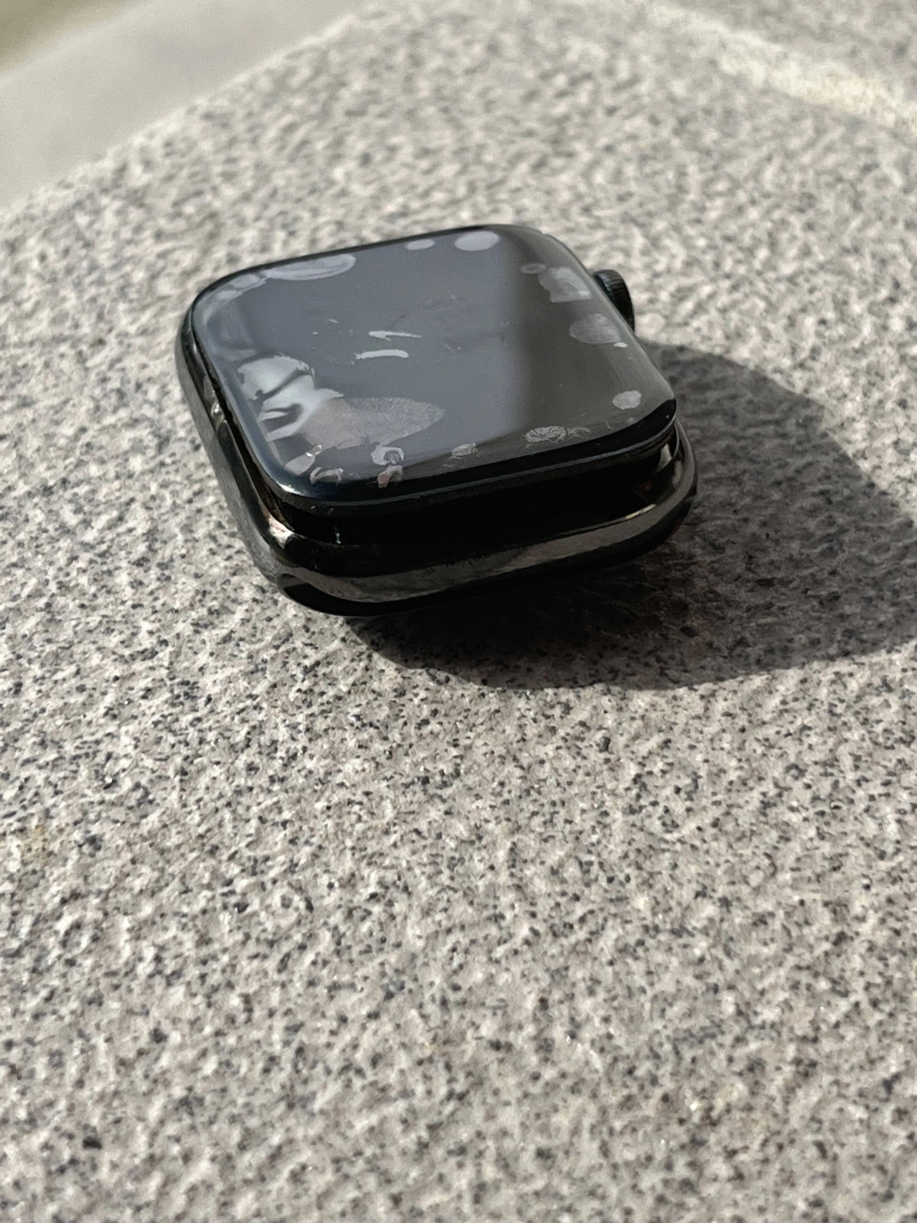 Su Apple Watch se sobrecalienta y termina en el servicio de urgencias (VIDEO)