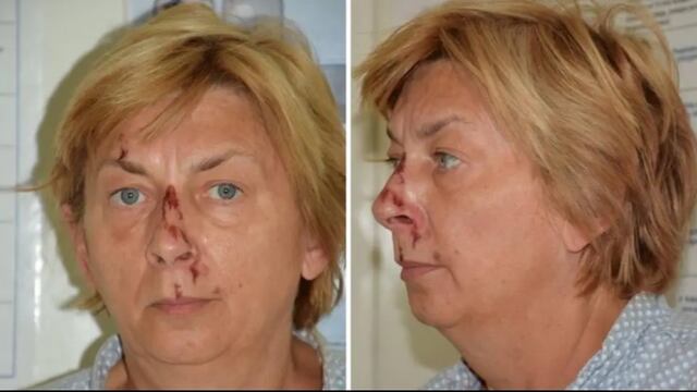 Mujer es rescatada de una isla en Croacia