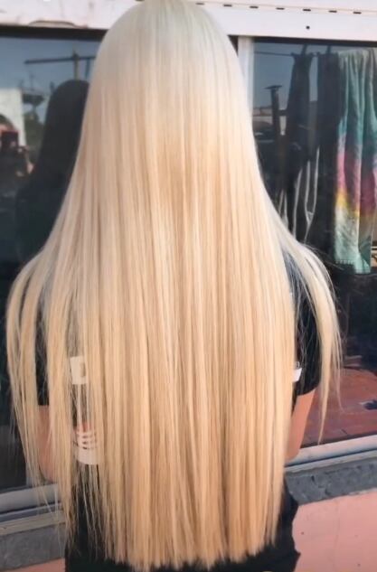 Queda calva antes de su fiesta de XV años