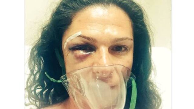 Ana Gabriela Guevara. Agresión.