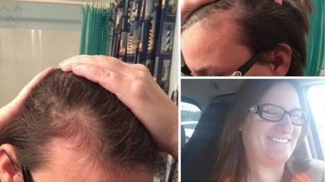 El uso de este shampoo te dejará calvo