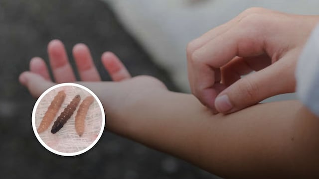 Gusano barrenador: primer caso en humanos en México