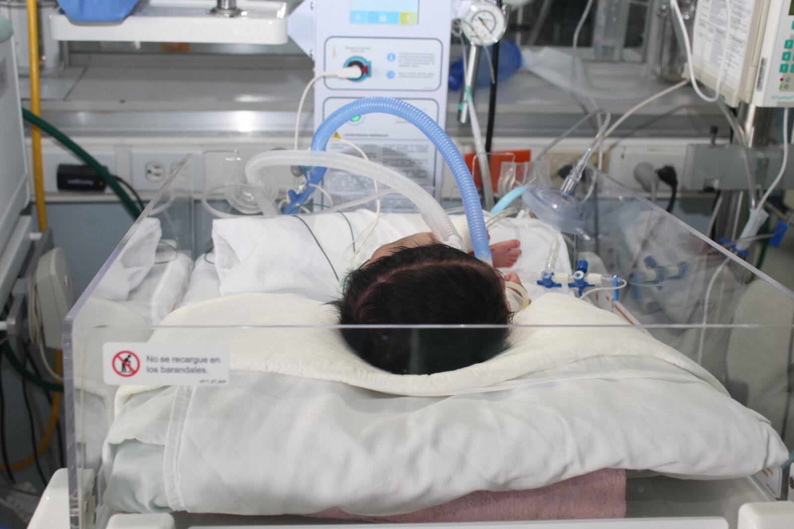 IMSS retiran tumor de 20 centímetros