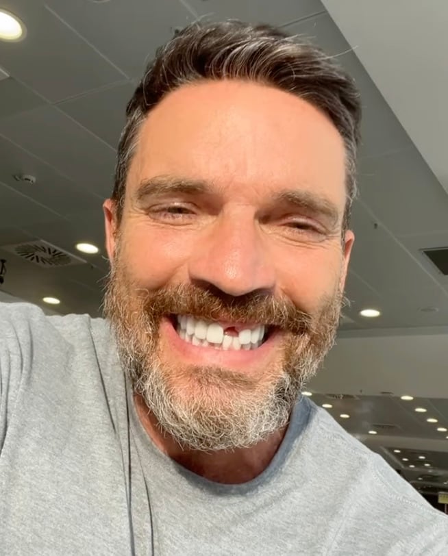 Julián Gil se quedó sin un diente